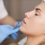 Dermal Filler Treatment